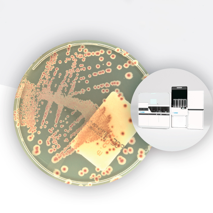 Infecciones urinarias inteligencia artificial -
Urinary tract infections IA